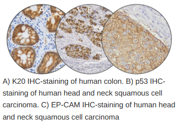 IHC-staining picture